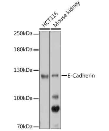 E-Cadherin Rabbit Polyclonal Antibody