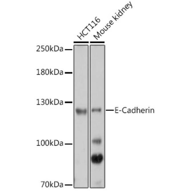 E-Cadherin Rabbit Polyclonal Antibody