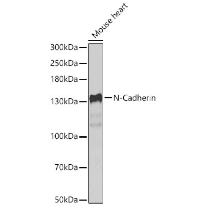 N-Cadherin Rabbit Polyclonal Antibody