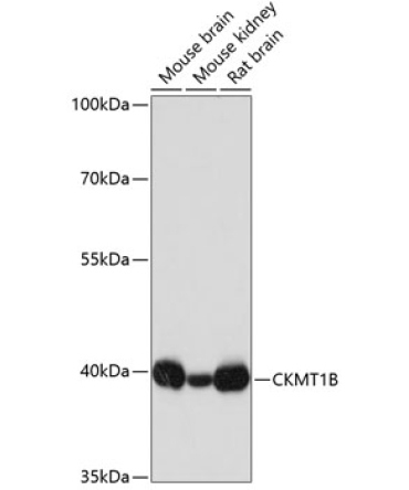 CKMT1B Rabbit Polyclonal Antibody