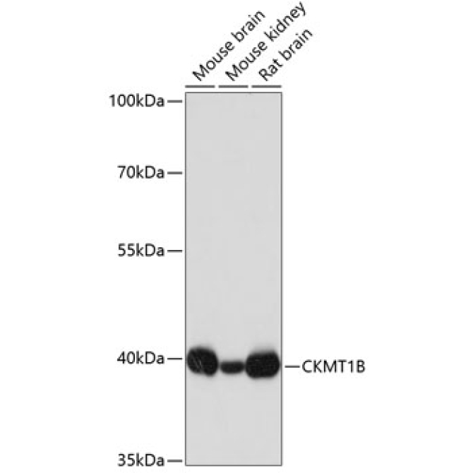 CKMT1B Rabbit Polyclonal Antibody
