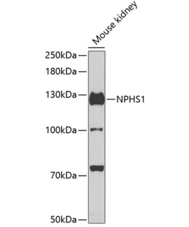 NPHS1 Rabbit Polyclonal Antibody