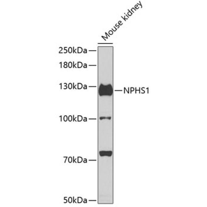 NPHS1 Rabbit Polyclonal Antibody