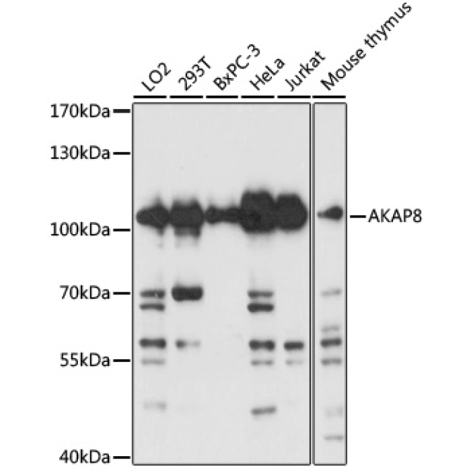 AKAP8 Rabbit Polyclonal Antibody