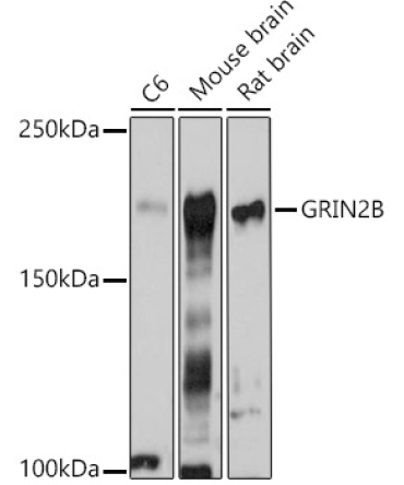 GRIN2B Rabbit Polyclonal Antibody