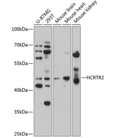 HCRTR2 Rabbit Polyclonal Antibody