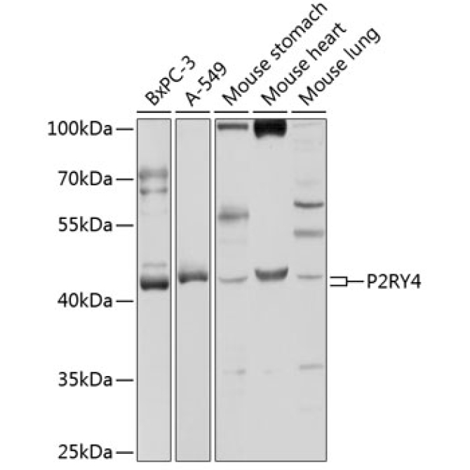 P2RY4 Rabbit Polyclonal Antibody