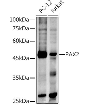 PAX2 Rabbit Polyclonal Antibody