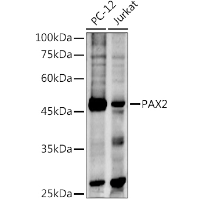 PAX2 Rabbit Polyclonal Antibody