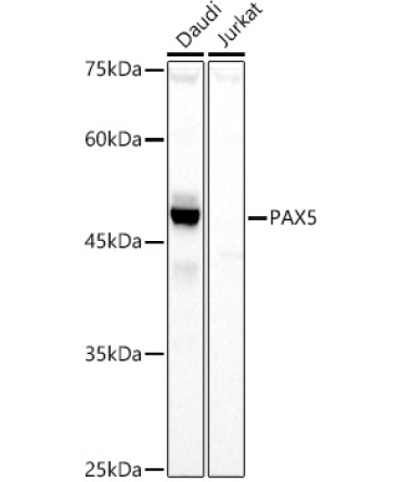 PAX5 Rabbit Polyclonal Antibody