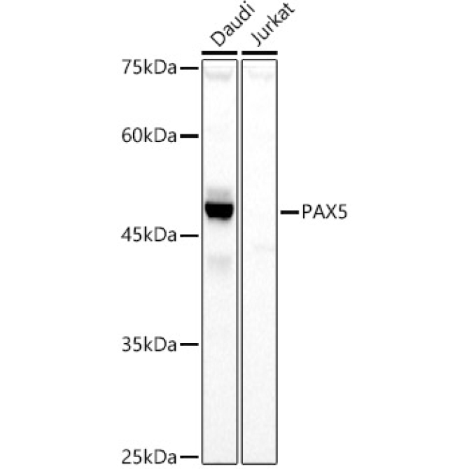 PAX5 Rabbit Polyclonal Antibody