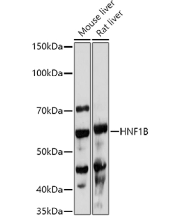 HNF1B Rabbit Polyclonal Antibody