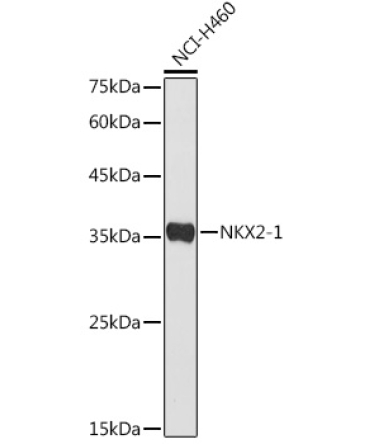 NKX2-1 Rabbit Polyclonal Antibody