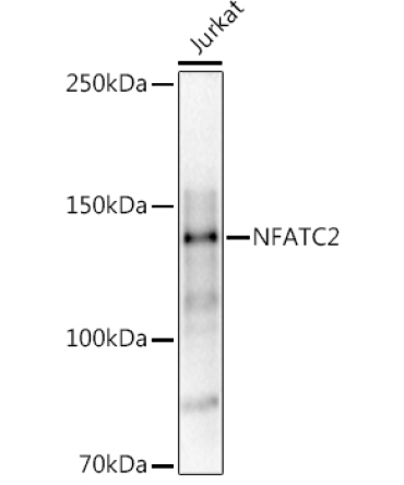 NFATC2 Rabbit Polyclonal Antibody