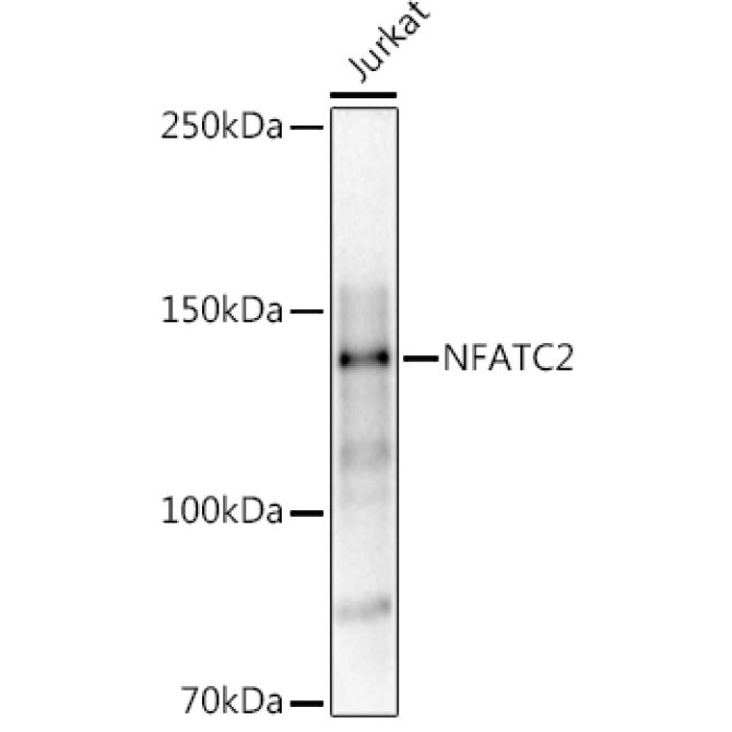 NFATC2 Rabbit Polyclonal Antibody