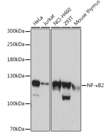 NF-?B2 Rabbit Polyclonal Antibody
