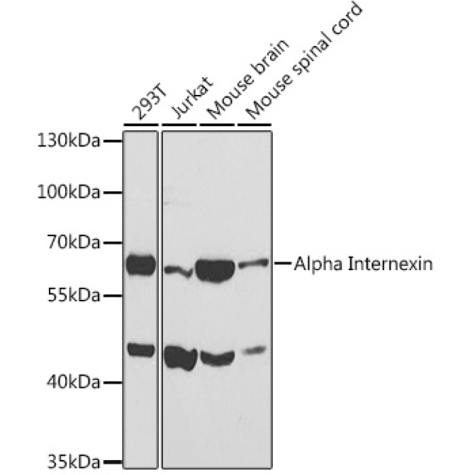 Alpha Internexin Rabbit Polyclonal Antibody