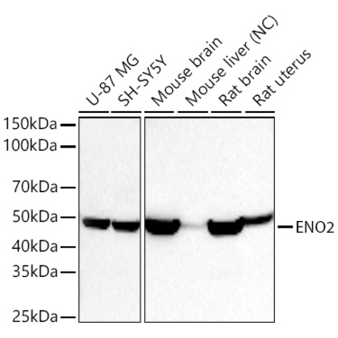 ENO2 Rabbit Polyclonal Antibody