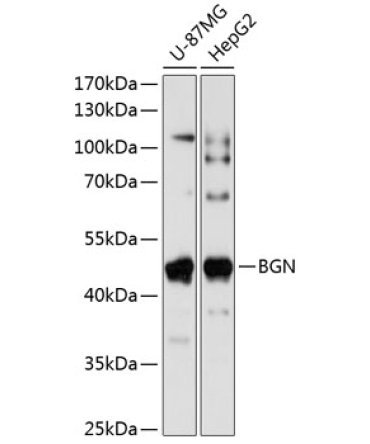 BGN Rabbit Polyclonal Antibody