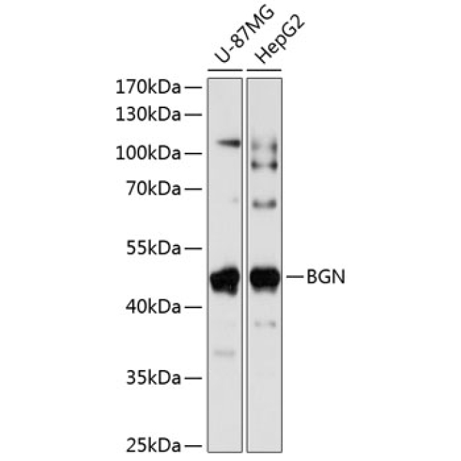 BGN Rabbit Polyclonal Antibody