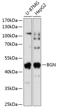 BGN Rabbit Polyclonal Antibody