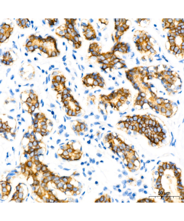 E-Cadherin mouse Monoclonal Antibody