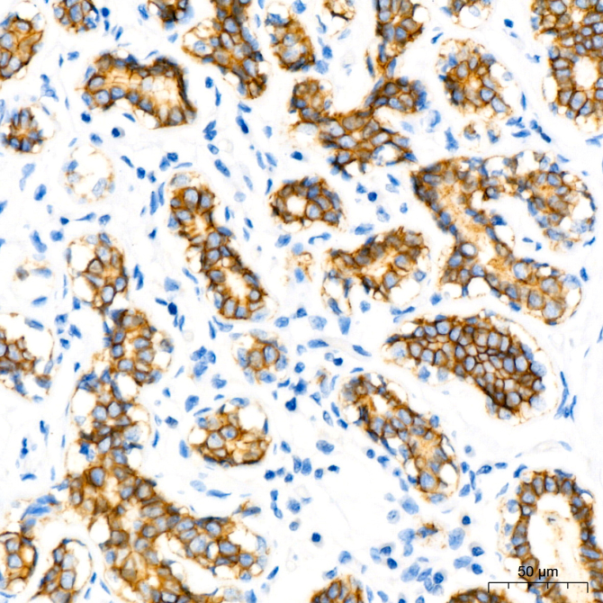 E-Cadherin mouse Monoclonal Antibody