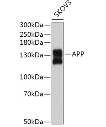 APP Rabbit Polyclonal Antibody