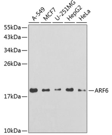 ARF6 Rabbit Polyclonal Antibody