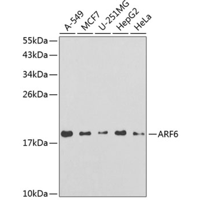 ARF6 Rabbit Polyclonal Antibody