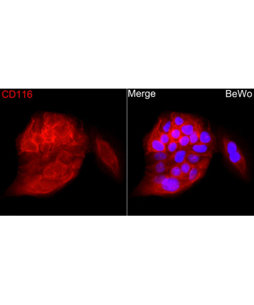 CSF2RA Rabbit Polyclonal Antibody