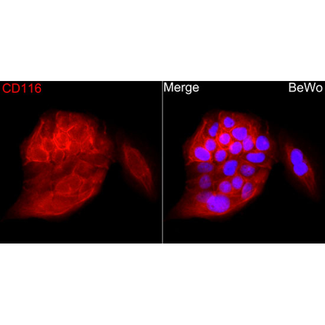 CSF2RA Rabbit Polyclonal Antibody