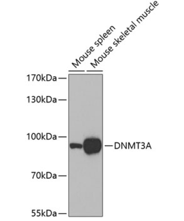 DNMT3A Rabbit Polyclonal Antibody
