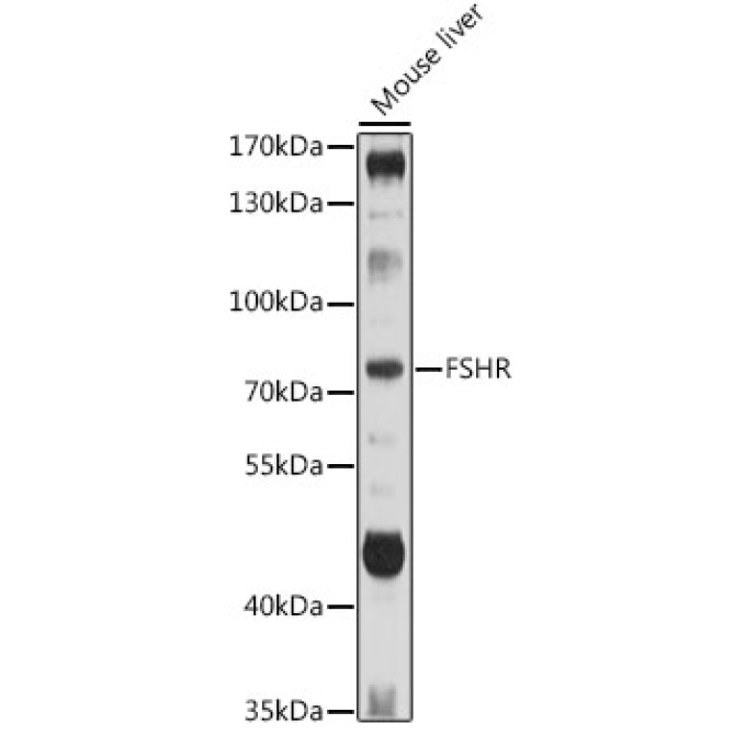 FSHR Rabbit Polyclonal Antibody