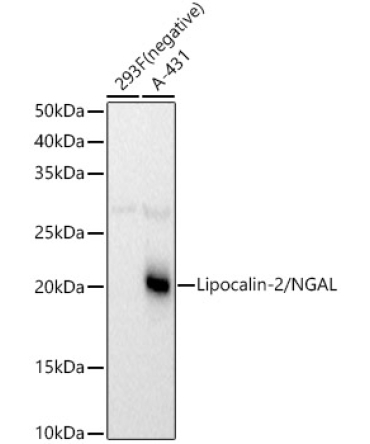 Lipocalin-2/NGAL Rabbit Polyclonal Antibody