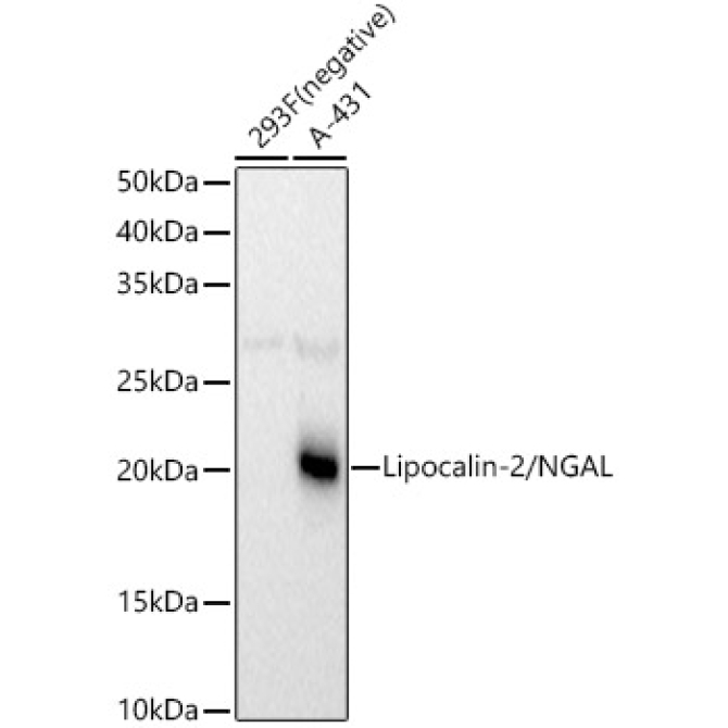 Lipocalin-2/NGAL Rabbit Polyclonal Antibody