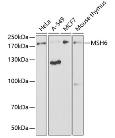 MSH6 Rabbit Polyclonal Antibody