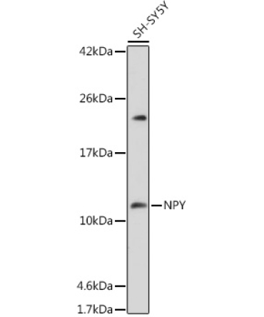 NPY Rabbit Polyclonal Antibody