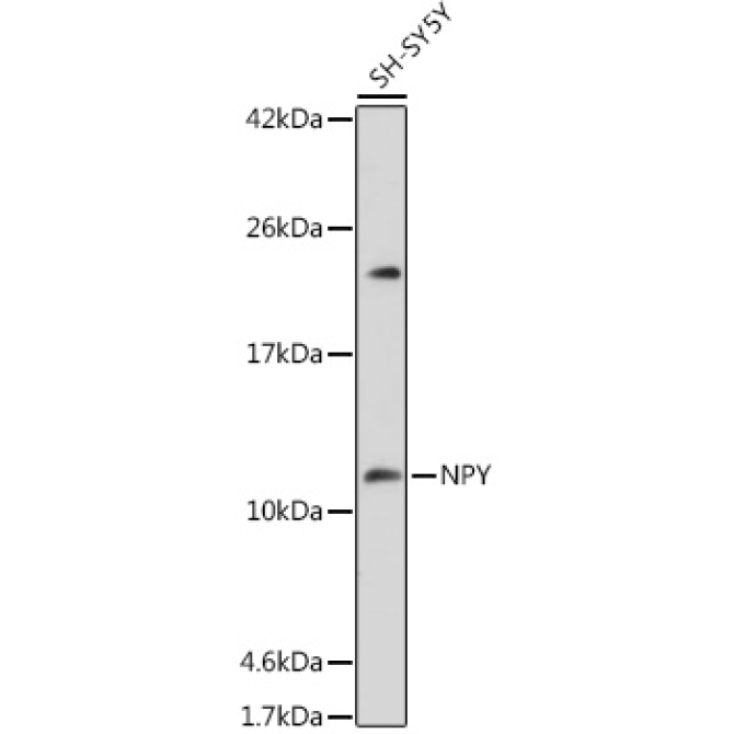 NPY Rabbit Polyclonal Antibody