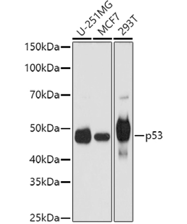 p53 Rabbit Polyclonal Antibody