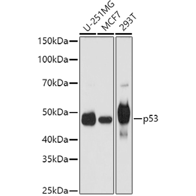 p53 Rabbit Polyclonal Antibody