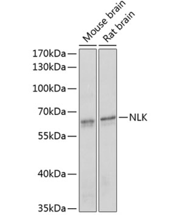 NLK Rabbit Polyclonal Antibody