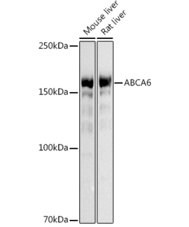 ABCA6 Rabbit Polyclonal Antibody