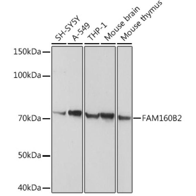 FAM160B2 Rabbit Polyclonal Antibody