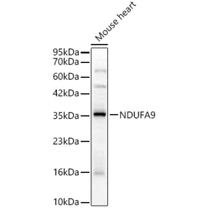 NDUFA9 Rabbit Polyclonal Antibody