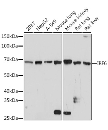 IRF6 Rabbit Monoclonal Antibody