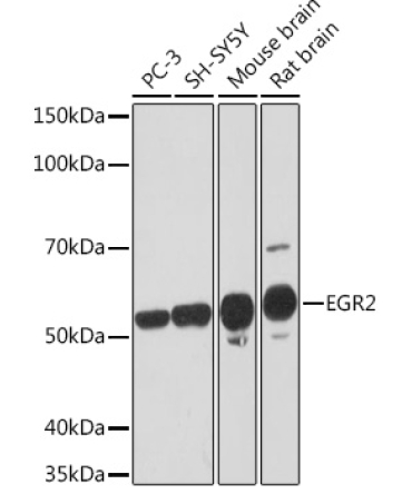 EGR2 Rabbit Monoclonal Antibody