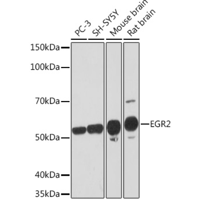 EGR2 Rabbit Monoclonal Antibody