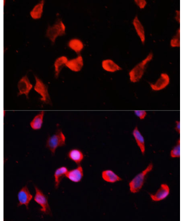 CAMK2G Rabbit Polyclonal Antibody