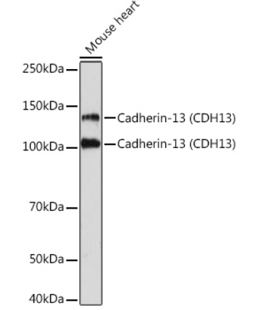 Cadherin-13 (CDH13) Rabbit Monoclonal Antibody